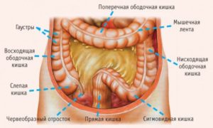 дисбактериоз кишечника у женщин